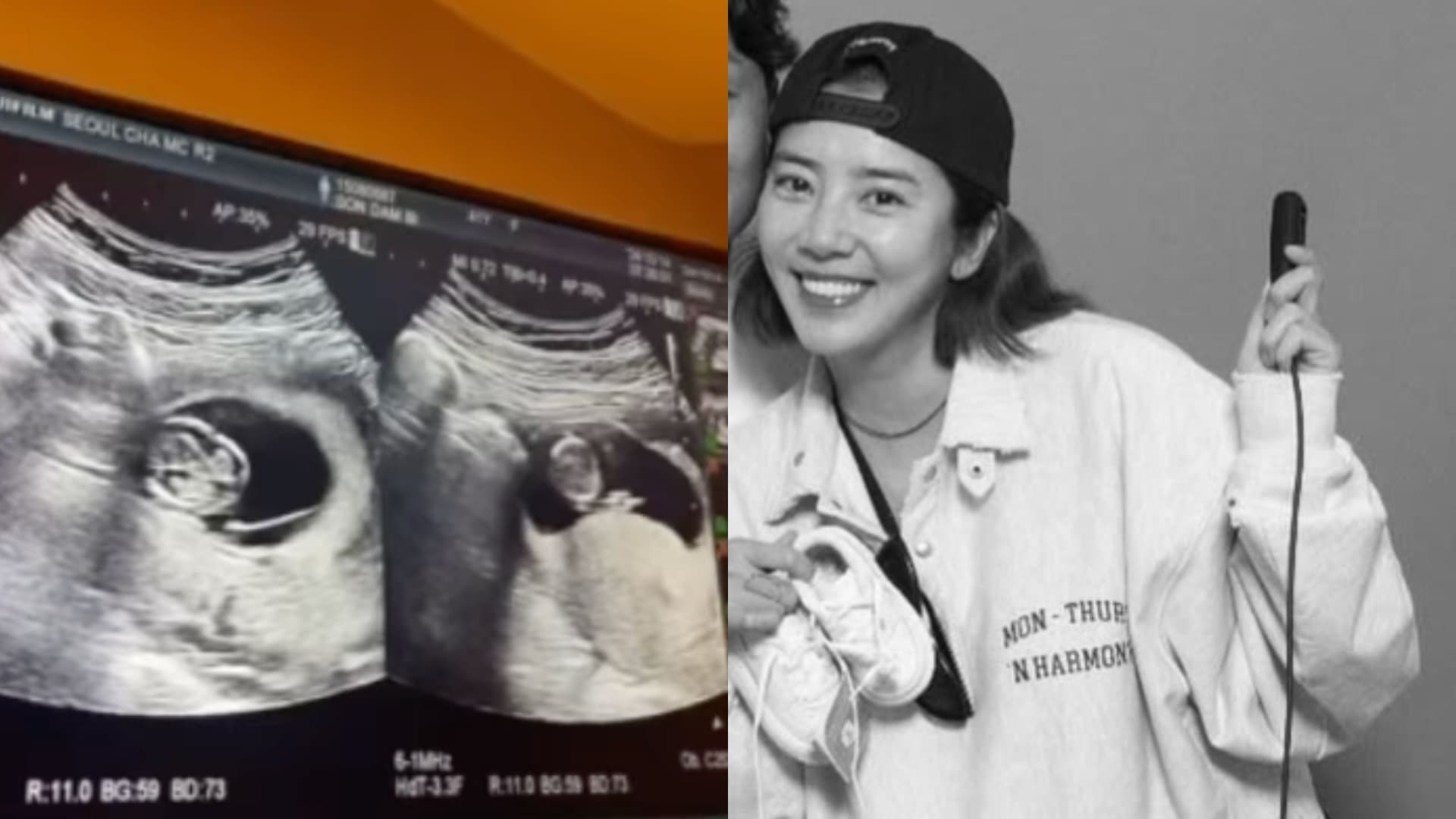 剩3個月準備卸貨!41歲高齡產婦孫淡妃突曝檢查結果:很受挫!